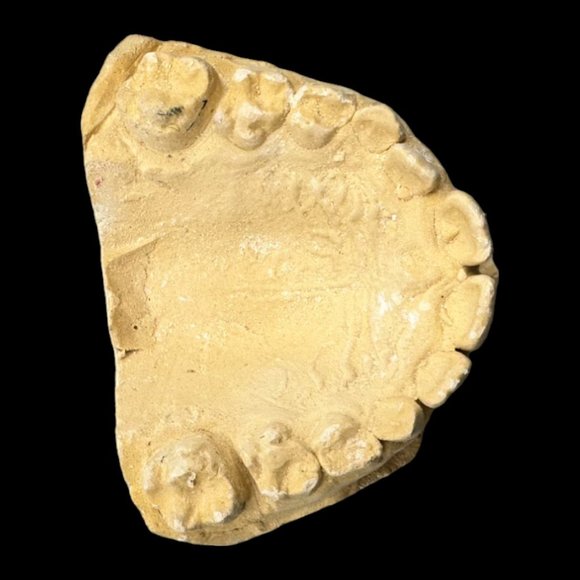Vintage Plaster Dental Mold - Teeth Tooth Mold - Creepy Oddity - Dental Oddities - Picture 15 of 16